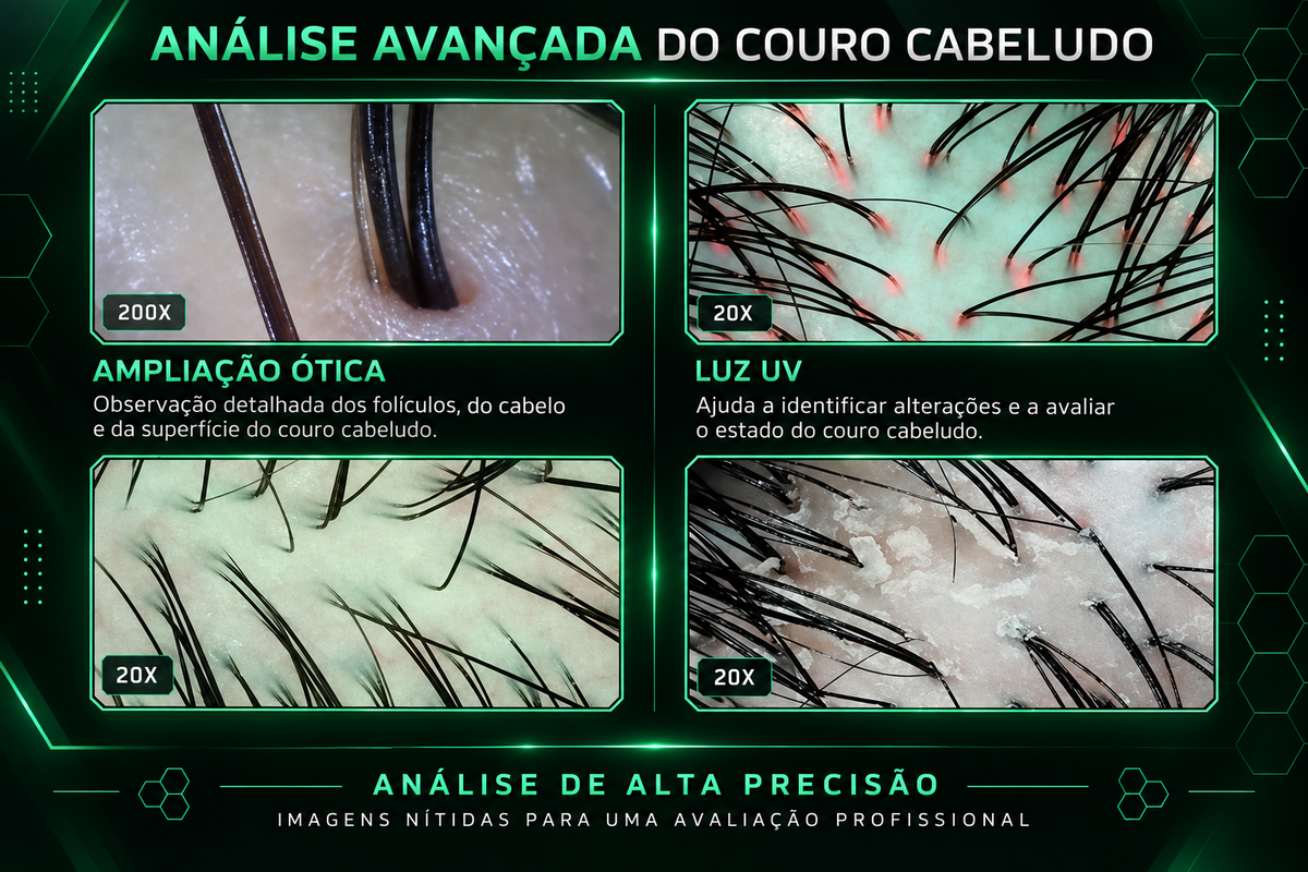 Analisador de Couro Cabeludo Portátil Inteligente com