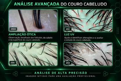Analisador de Couro Cabeludo Portátil Inteligente com