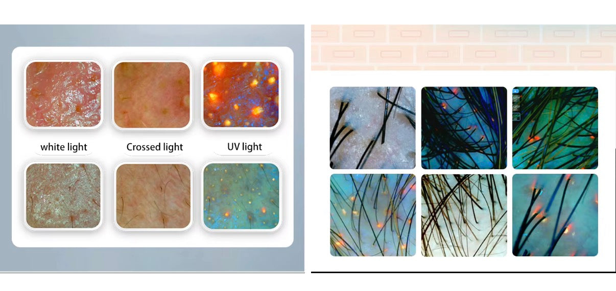 Analisador de pele e de Couro Cabeludo