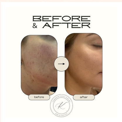 Curso Online de Peeling Mar Morto Premium