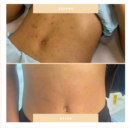 Curso Online de Peeling Mar Morto Premium