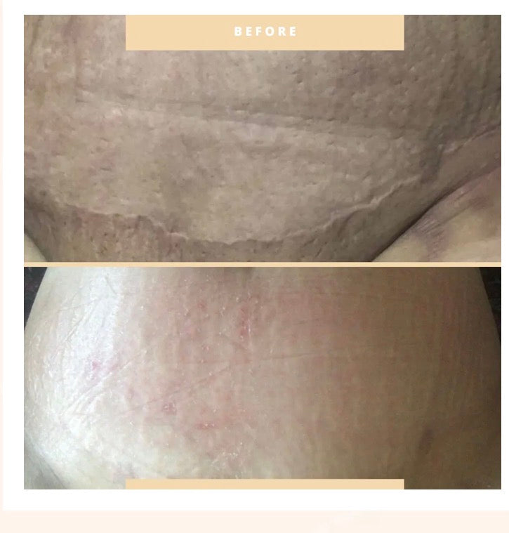 Curso Online de Peeling Mar Morto Premium